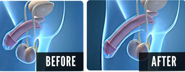 Before & After